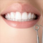 3 Reasons Your 2026 Invisalign Trays Feel Loose on One Side