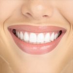 4 New 2026 Teeth Cleaning Fixes That Stop Enamel Loss