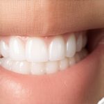 4 Simple Fixes for Invisalign Tray Flex in 2026