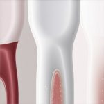 4 Ways This 2026 Mineral Seal Stops Post-Cleaning Plaque Build-Up