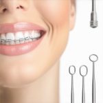 5 Tactics for Fixing Asymmetrical Teeth in 2026 [Proven]