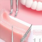 Stop Invisalign 'Bounce': 3 Quick 2026 Fixes for Better Seating