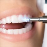 Stop Scraper Pain: 4 Ways 2026 Laser Cleanings Save Gums